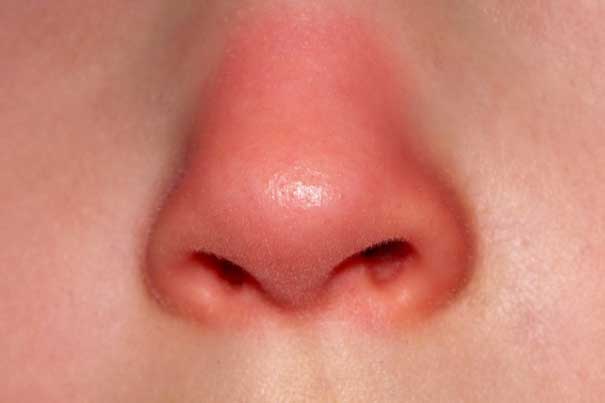 Nếu mũi xuất hiện 4 dấu hiệu lạ này chứng tỏ sức khỏe của bạn đang có vấn đề, đừng chủ quan