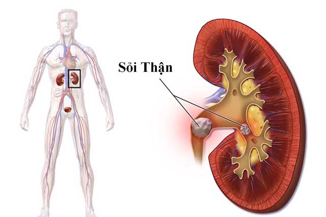 Nếu có dấu hiệu này chắc chắn bạn đang mắc bệnh rất nặng về thận, đừng chần chừ hãy đi khám bác sỹ ngay