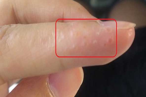 Nếu bạn nhận thấy dấu hiệu này cần lập tức tới bệnh viện ngay kẻo cứu không kịp