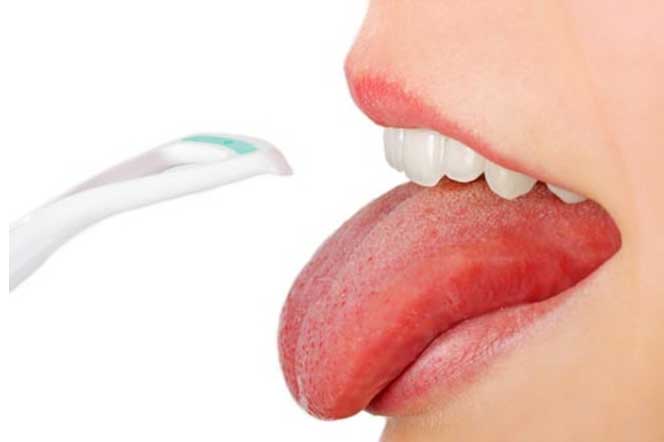 Điểm mặt 6 dấu hiệu bất thường ở vùng lưỡi cảnh báo vấn đề nguy hiểm về sức khỏe không thể bỏ qua