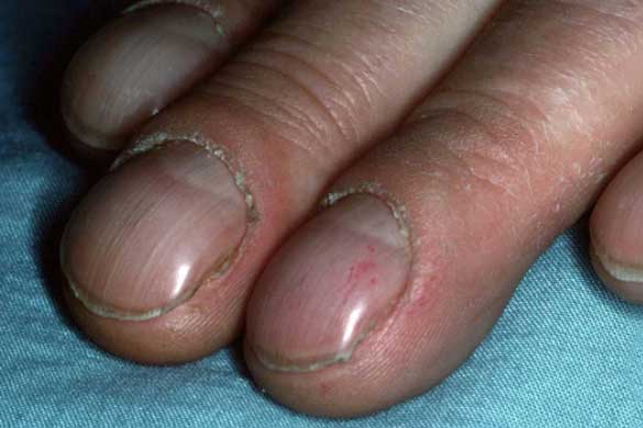 Nhìn ngay vào dấu hiệu này ở mắt, tai và ngón tay, bạn sẽ biết tim mình có khỏe mạnh hay không