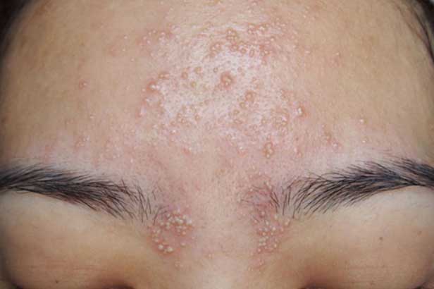 Nếu trả lời “có” 6 câu hỏi này, thận của bạn đã nhiễm độc nặng, hãy đi khám ngay trước khi quá muộn