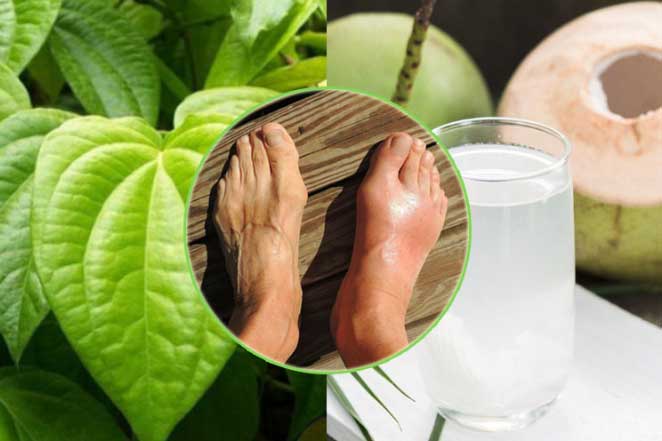 Người bệnh Gout vui hơn bắt được vàng khi trị khỏi tiệt đau nhức trong 7 ngày chỉ với nguyên liệu mọc đầy vườn