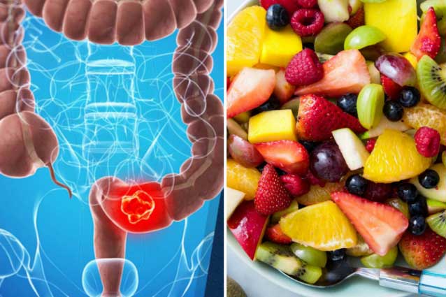 Ăn 5 món này vừa sạch ruột vừa loại bỏ mầm mống ung thư đại trực tràng