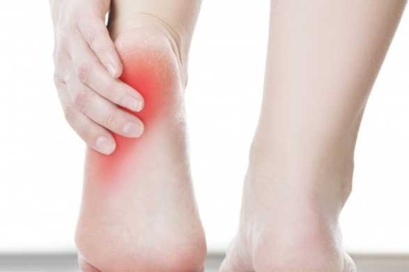 Thấy gót chân bị đau kiểu này, hãy cảnh giác vì căn bệnh nguy hiểm đang "gõ cửa"