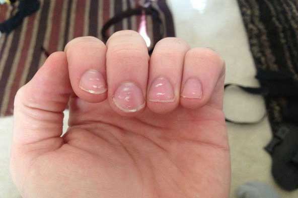 Những dấu hiệu cảnh báo gan nhiễm bệnh, bạn nên đi khám sớm để bảo vệ sức khỏe