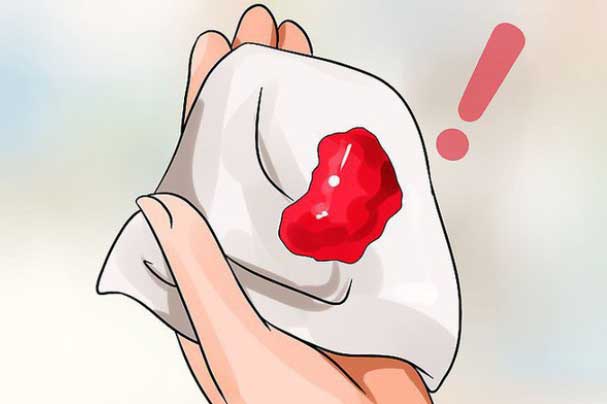 Chỉ một dấu hiệu này, nhiều chị em đi khám bất ngờ phát hiện mang "án tử ung thư"