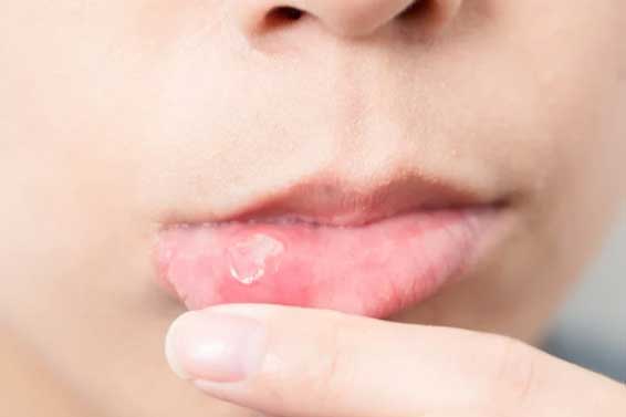 Đang "khốn khổ" vì nhiệt miệng, hãy uống ngay loại nước ép này, điều thần kỳ sẽ xảy ra chỉ sau 1 đêm