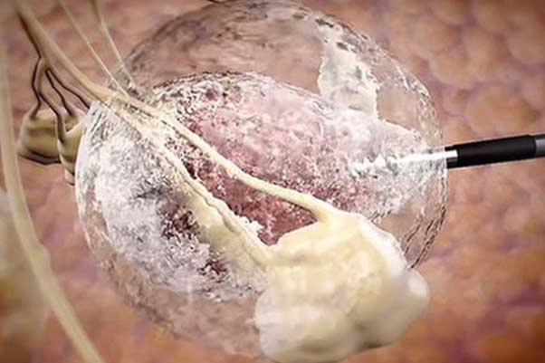 Cách ăn uống lành mạnh và những lời cảnh báo quan trọng để "xoá sổ" mầm mống ung thư