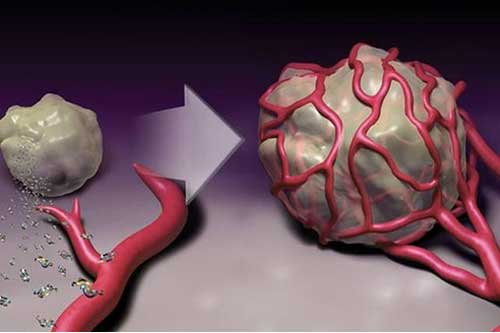 Khoa học chỉ ra 5 nhóm người rất khó bị ung thư tấn công và bí quyết vô cùng đơn giản