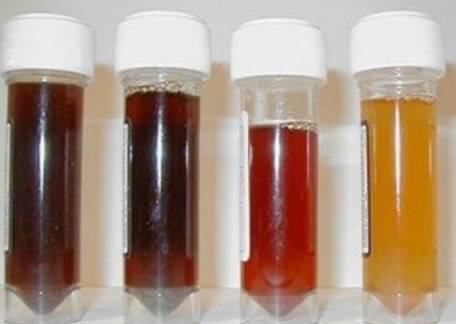 
Bạn có thể chết sớm nếu gặp dấu hiệu này mà không đi khám ngay