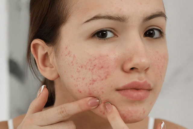 Các dấu hiệu cho thấy bạn đang dùng sai mỹ phẩm