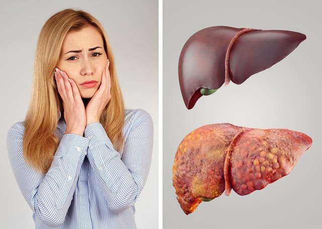 Có những dấu hiệu này chứng tỏ bạn cần giải độc cơ thể ngay lập tức