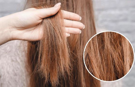 Nguyên nhân khiến tóc bạn ngày càng xơ xác