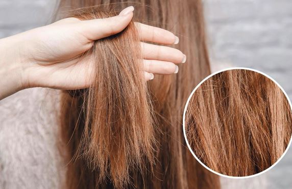 Nguyên nhân khiến tóc bạn ngày càng xơ xác