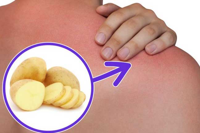 Điều kỳ diệu xảy ra với cơ thể khi bạn ăn khoai tây mỗi ngày, số 1 rất ít người biết