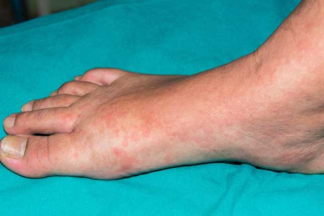 10 thay đổi trên da ''tố cáo'' bạn đang mắc bệnh, càng để lâu càng nguy hiểm đến tính mạng