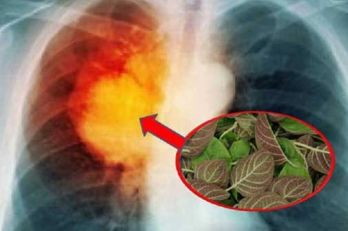 Dùng 1 nắm lá mơ lông, lá phổi viêm trắng phếu cũng khỏi sau 1 tuần, hiệu quả khiến ai cũng bất ngờ