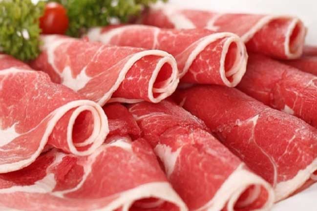 Bác sĩ chỉ điểm 5 nguyên nhân gây bệnh sỏi thận hàng đầu hiện nay, số 1 rất quen mặt