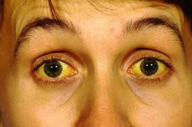 4 tín hiệu "lạ" trên mặt cảnh báo mầm bệnh nguy hiểm đang "lớn" dần, hãy nhanh chân đi gặp bác sĩ