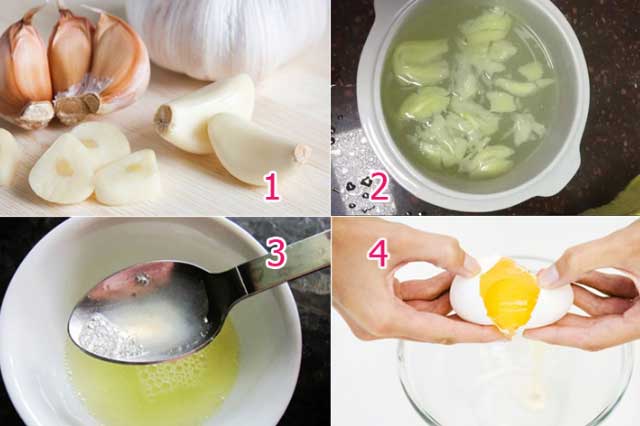 5 nguyên liệu rẻ tiền trị tận gốc giun sán không cần tốn 1 viên thuốc, vừa an toàn vừa hiệu quả