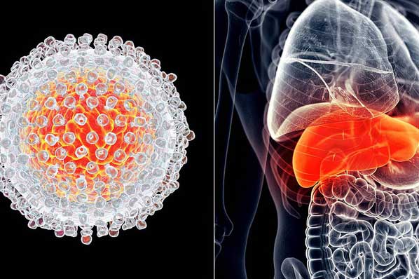 Bác sĩ chỉ mặt 5 đối tượng có nguy cơ mắc ung thư gan gấp 200 lần, biết sớm để tự cứu lấy mình