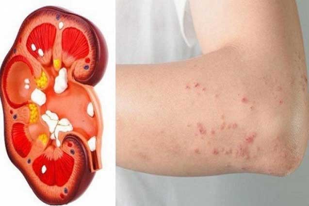 Trả lời "có" với 4 câu hỏi này là thận đang "gửi lời" cảnh báo bệnh nặng, hãy nhanh chân đến gặp bác sĩ