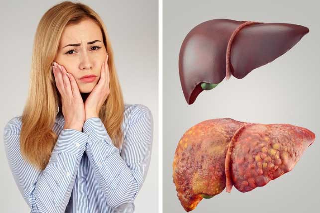 3 bộ phận này trên cơ thể ngày càng 'đen', báo hiệu gan đang suy yếu hãy đi gặp bác sĩ ngay còn kịp