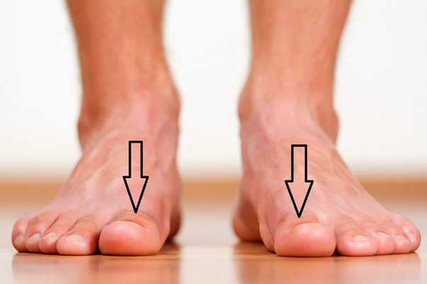 Bàn chân xuất hiện cùng lúc 3 dấu hiệu này: Cảnh báo thận đang "kêu cứu" gấp, hãy đi kiểm tra ngay