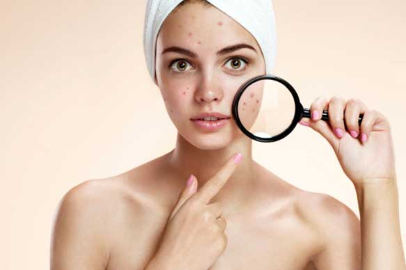 Bỗng nhiên mọc mụn ở những vị trí này, hãy đến bệnh viện khám ngay lập tức kẻo hối không kịp