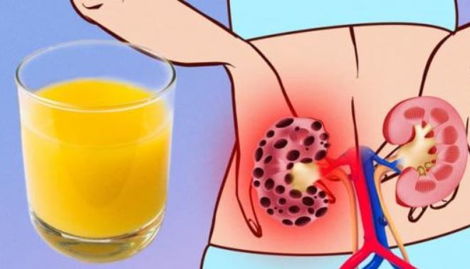 7 loại thực phẩm gây hại cho thận, nhiều người lại coi đấy là "món tủ"