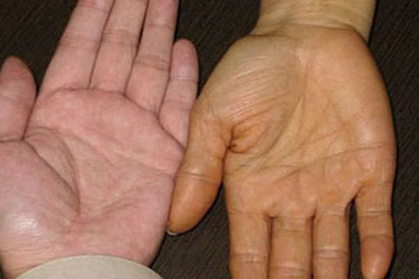 Dấu hiệu cảnh báo cơ thể đang có vấn đề về sức khỏe