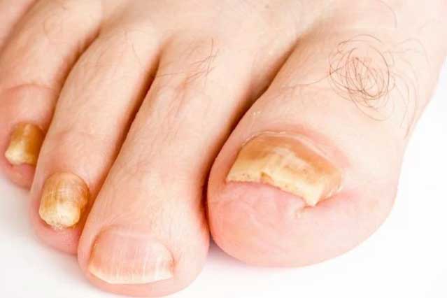 10 dấu hiệu trên bàn chân tưởng chừng "vô hại" nhưng lại cảnh báo vấn đề nghiêm trọng về sức khỏe, cần khám ngay