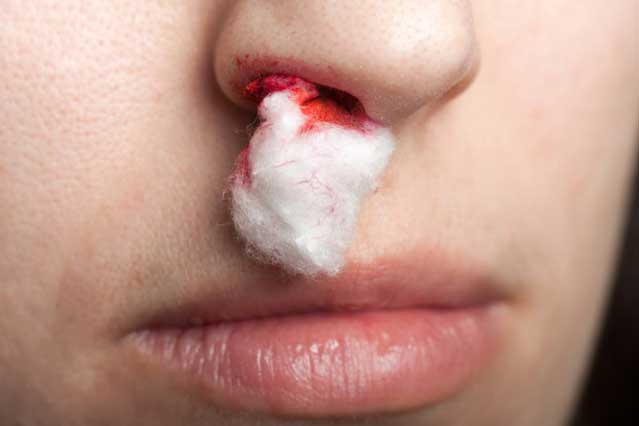 7 triệu chứng không đau nhưng có thể là dấu hiệu sớm của ung thư, hãy nhanh chóng đi gặp bác sĩ