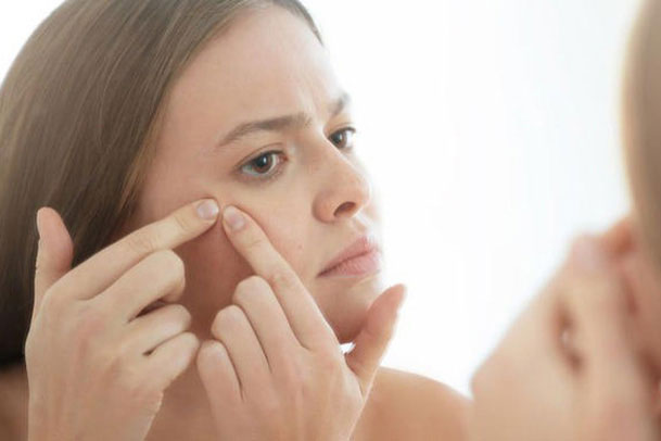 Mẹo nặn mụn hiệu quả mà không để lại thâm sẹo