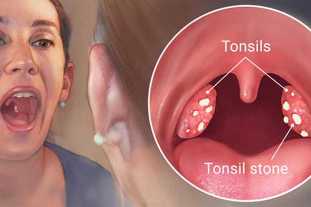 5 dấu hiệu ở miệng cảnh báo ung thư, thấy đau phải đi khám ngay kẻo hối không kịp