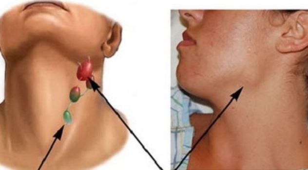 7 vị trí đau cảnh báo cơ thể đang bị tấn công nặng, số 7 nhiều người chủ quan