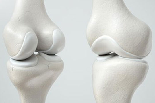 Can thi&#x1EC7;p chi&#x1EC1;u cao khi n&#xE0;o hi&#x1EC7;u qu&#x1EA3;?