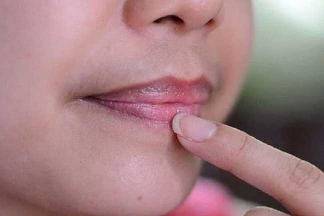 Môi có dấu hiệu này là cơ thể đang cảnh báo vấn đề sức khoẻ nghiêm trọng, đừng chủ quan