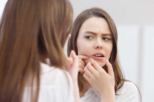 Vùng "tam giác tử thần" trên mặt, tuyệt đối không được nặn mụn