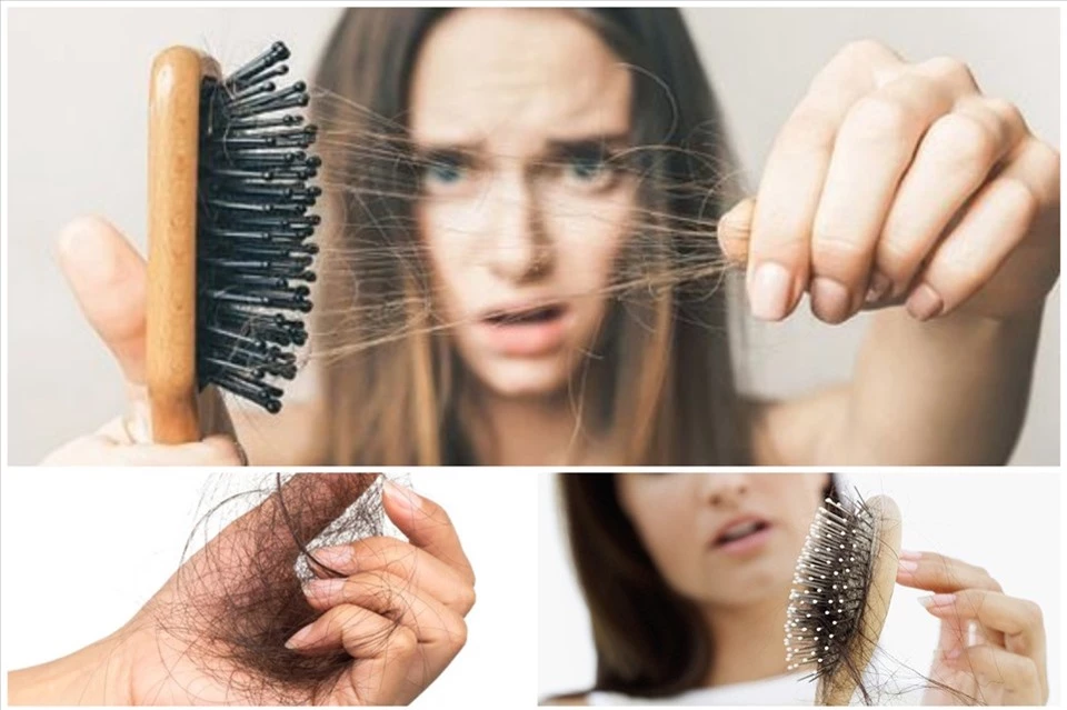 Giải pháp khắc phục tình trạng tóc rụng triệt để