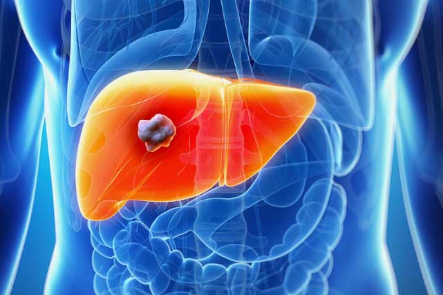 Thấy có dấu hiệu này, cẩn thận gan, mật đang gửi lời cảnh báo bệnh nặng, hãy nhanh chóng đi gặp bác sĩ