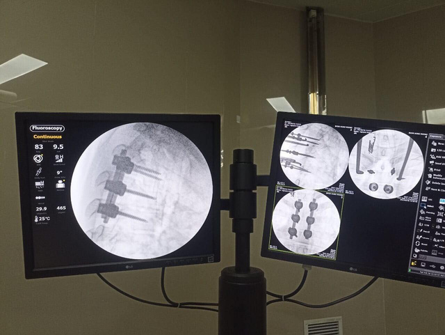 Phú Thọ: Nam thanh niên suýt liệt chân do tập gym