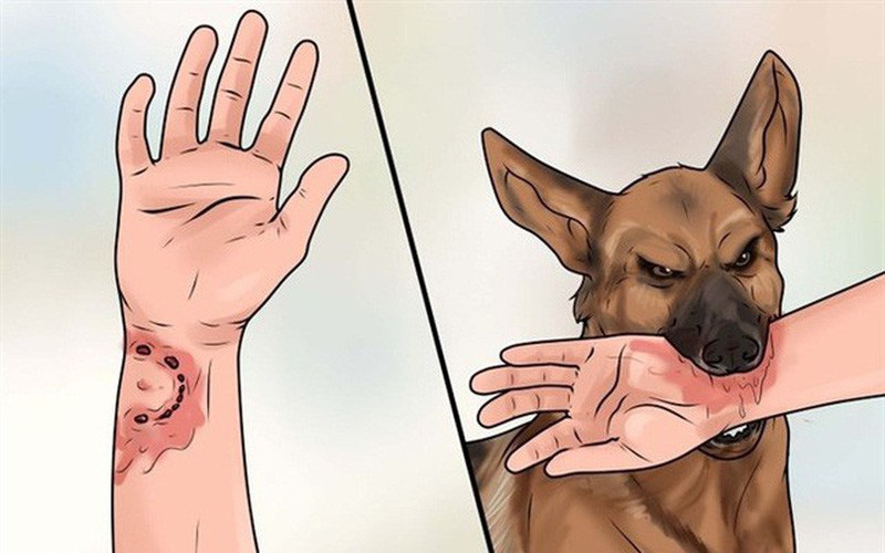 Tăng cường chủ động phòng chống bệnh dại ở người