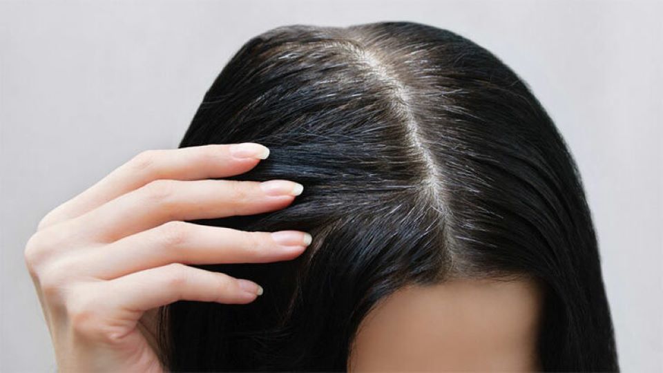 9 mẹo tuyệt vời giúp bạn chống lại tình trạng tóc bạc sớm
