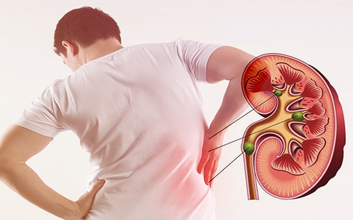 Nh&#x1EEF;ng y&#x1EBF;u t&#x1ED1; l&#xE0;m t&#x103;ng nguy c&#x1A1; b&#x1ECB; s&#x1ECF;i th&#x1EAD;n