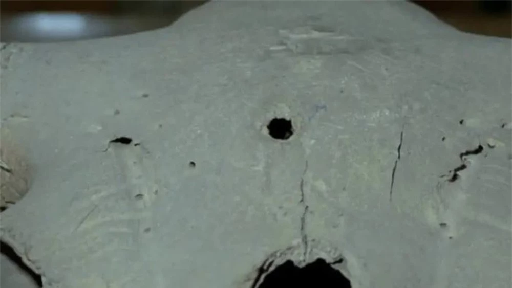 Tại sao lại có lỗ đạn xuất hiện trên các hộp sọ tiền sử? - Ảnh 1.