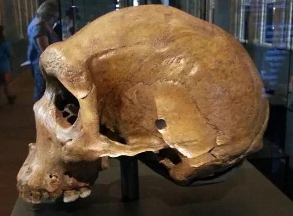 Tại sao lại có lỗ đạn xuất hiện trên các hộp sọ tiền sử?