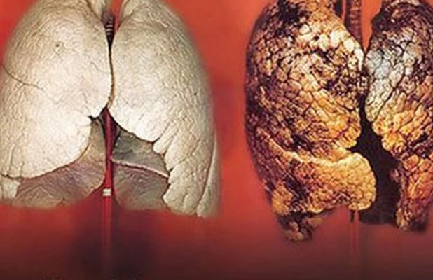 Chỉ ra loại quả ăn vào sẽ lọc sạch phổi cho người hút thuốc lá