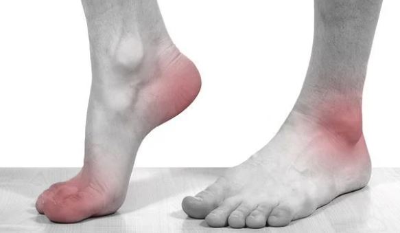 5 dấu hiệu ở chân cảnh báo bệnh nguy hiểm: Ai không có thật đáng chúc mừng